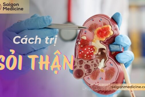 Cách Trị Sỏi Thận: 5 Phương Pháp Bạn Không Thể Bỏ Qua