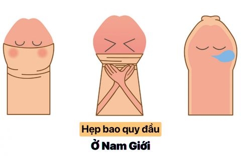 Hẹp Bao Quy Đầu: Nỗi Đau Thầm Kín Cánh Mày Râu