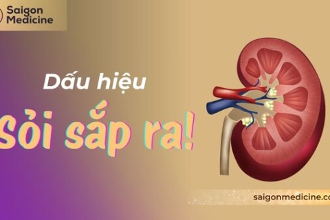 Dấu Hiệu Sỏi Sắp Ra: Hiểu Biết & Hành Động Hiệu Quả