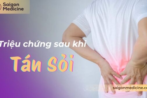 Triệu Chứng Sau Khi Tán Sỏi Thận: Dấu Hiệu và Cảnh Báo