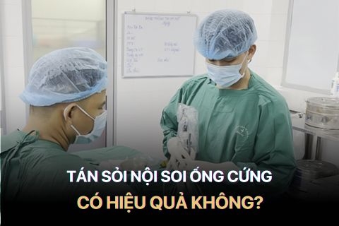 Từ A tới Z Về Phương Pháp Tán Sỏi Nội Soi Bằng Ống Cứng