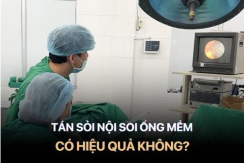 Tất tần tật về tán sỏi thận nội soi ngược dòng bằng ống mềm