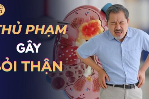 Thủ Phạm Gây Sỏi Thận Ít Ai Ngờ: 5 Cách Ngăn Ngừa Hiệu Quả Và 3 Hiểu Lầm Phổ Biến Nhất