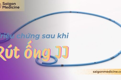 Triệu Chứng Sau Khi Rút Ống JJ: Sự Thật Bạn Cần Biết