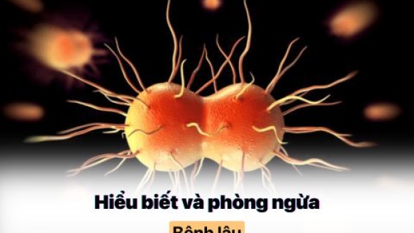 Chàng Trai Trẻ Chiến Thắng Bệnh Lậu: Lời Khuyên Ai Cũng Cần Nghe!