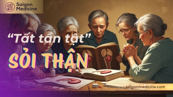 Bệnh Sỏi Thận Là Gì? Nguyên nhân, Phân loại, Triệu chứng