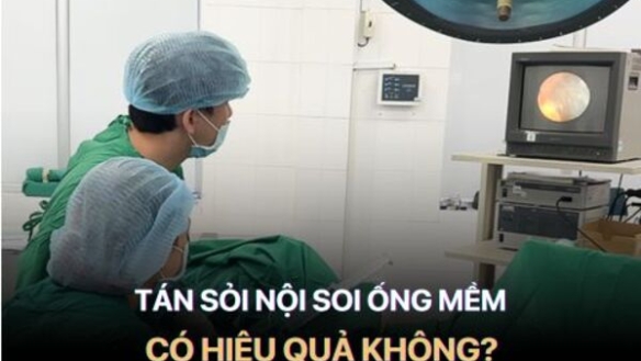 Tất tần tật về tán sỏi thận nội soi ngược dòng bằng ống mềm