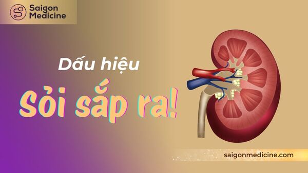 Dấu hiệu sỏi sắp ra: Nhận biết và hành động kịp thời