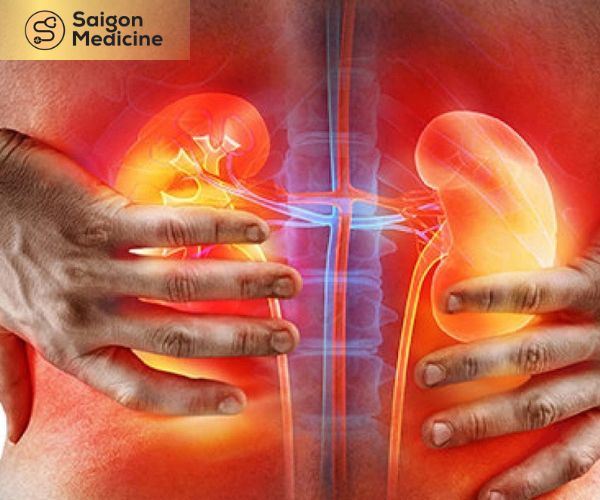 Không điều trị sỏi thận sẽ gây ra hậu quả khôn lường