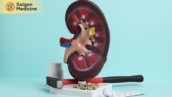 Sỏi thận có thể tự đào thải hay không