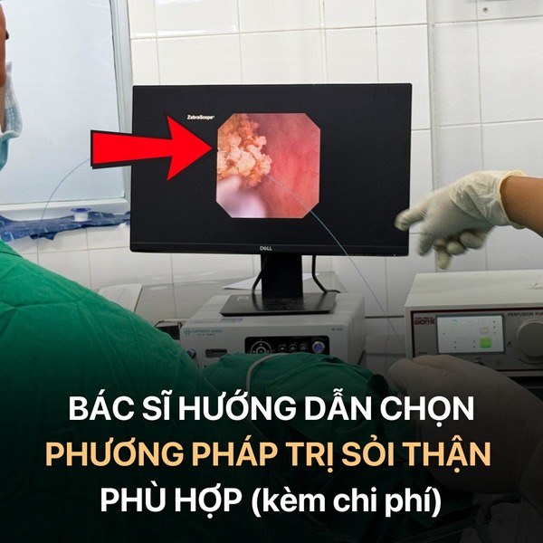 Phương pháp trị sỏi thận và dự đoán chi phí chuẩn xác