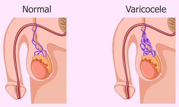 Mức độ đau sau khi mổ