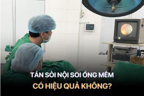 Phương pháp tán sỏi nội soi ống mêm có hiệu quả không? BS Trần Quốc Phong chia sẻ kinh nghiệm